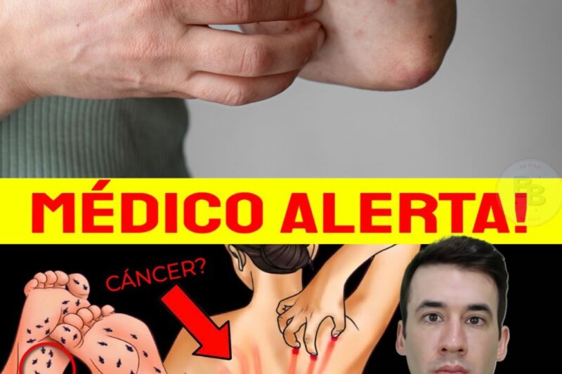 Aquela coceira boba que você ignora pode ser o último aviso do seu corpo antes de uma falência de órgãos. Sabia que coçar a nuca, as pernas ou a palma das mãos revela segredos assustadores sobre o seu fígado, seus rins e até a viscosidade do seu sangue? Não é apenas pele seca; pode ser um câncer oculto ou diabetes silencioso destruindo você por dentro. O tempo é o seu maior inimigo quando os sinais aparecem na pele. Descubra agora o que cada lugar da coceira significa e como salvar sua vida antes que seja tarde demais. Detalhes completos no link do primeiro comentário.