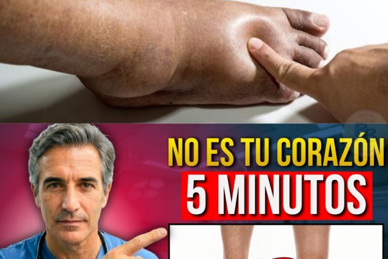 Seus tornozelos estão inchados e você vive com medo de ser o coração? Pare tudo o que está fazendo! O Dr. Alejandro Gómez acaba de revelar que, após os 60 anos, o problema raramente é o que você pensa. Não é falência cardíaca, é o seu “sistema de esgoto” corporal que está entupido! Milhares de pessoas estão sofrendo sem necessidade porque ninguém explicou como drenar esse líquido acumulado em apenas 5 minutos. Descubra agora o protocolo secreto que vai devolver a leveza às suas pernas e acabar com a angústia de uma vez por todas. O passo a passo completo está no primeiro comentário!