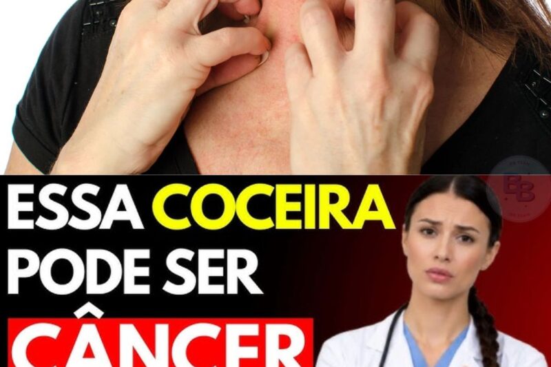 Nunca ignore coceira em certas áreas do corpo: 5 sinais que podem indicar câncer se desenvolvendo silenciosamente! Especialistas alertam que sintomas aparentemente comuns podem esconder problemas graves. Descubra agora quais regiões observar e como agir imediatamente, todos os detalhes estão nos comentários!