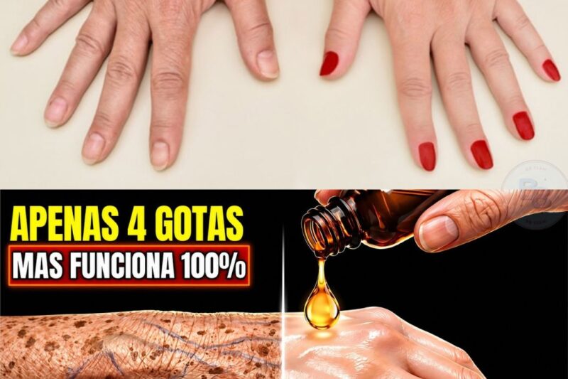 URGENTE: Rugas e manchas nas mãos podem desaparecer em apenas 7 dias! Descubra o segredo que especialistas recomendam aplicar todas as noites antes de dormir e transforme suas mãos visivelmente. Milhares de pessoas já estão surpresas com os resultados. Quer saber como fazer corretamente? Todos os detalhes estão nos comentários!