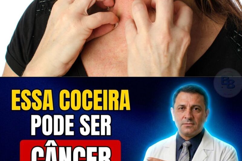 Aquela coceira que você ignora há semanas pode ser o grito de socorro do seu próprio corpo. Muitos pacientes descartam como alergia ou pele seca, mas o Dr. André Tavares revela que em mais de 40% dos casos de câncer avançado, uma coceira específica em zonas estratégicas foi o primeiro sintoma detectado meses antes do diagnóstico. O segredo está em saber identificar o padrão correto de alerta antes que seja tarde demais. Descubra hoje mesmo as cinco zonas do corpo que exigem atenção médica imediata lendo o artigo abaixo.