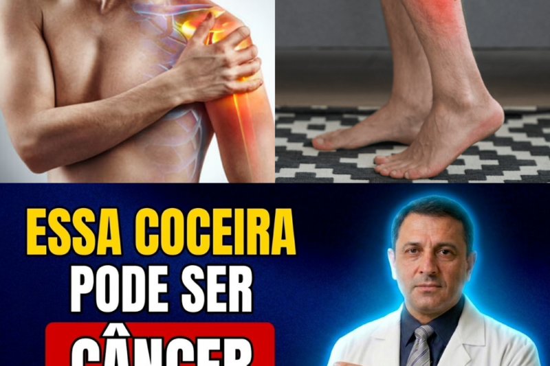 O ALARME MORTAL QUE VOCÊ CHAMA DE “PELE SECA”: 5 Coceiras Silenciosas que Escondem o CÂNCER