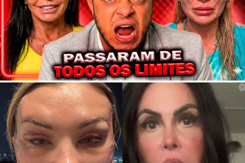IGUAIS? Público compara Andressa Urach à Gretchen e médico EXPÕE SITUAÇÃO DELICADA!