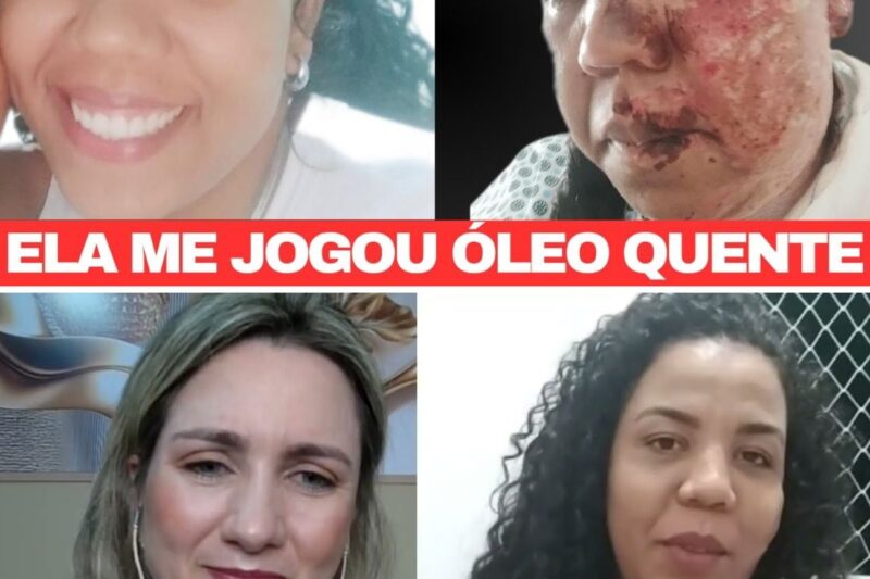 “ISTO É PARA APRENDERES A NUNCA MAIS ROUBAR O MARIDO DOS OUTROS!”: O cruel ataque com óleo fervente planejado por Naiane que desfigurou a cantora Tamires Umburana e a chocante inversão da justiça baiana