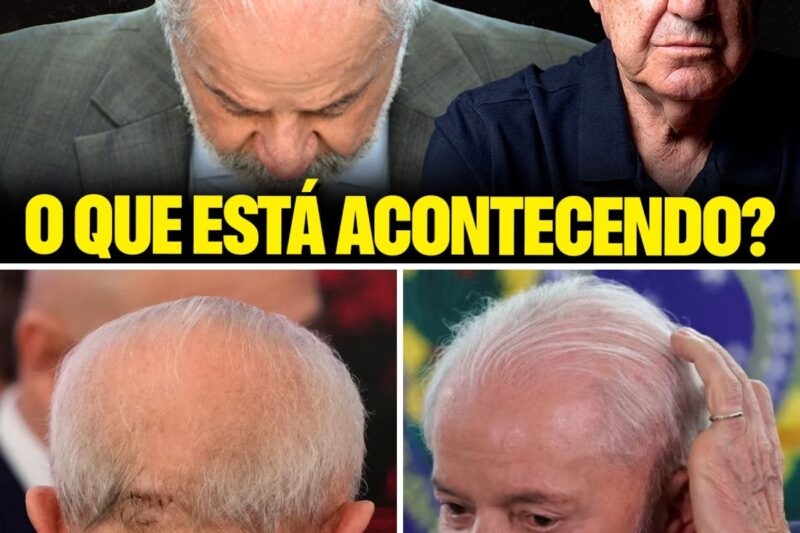 “NÃO FALE COM NINGUÉM COMO É QUE EU ESTOU!”: O Uso Constante de Chapéu, as 15 Sessões Ocultas de Radioterapia no Sírio-Libanês e o Plano Secreto do PT para Trocar Alckmin por Haddad Diante da Gravidade do Câncer de Pele de Lula