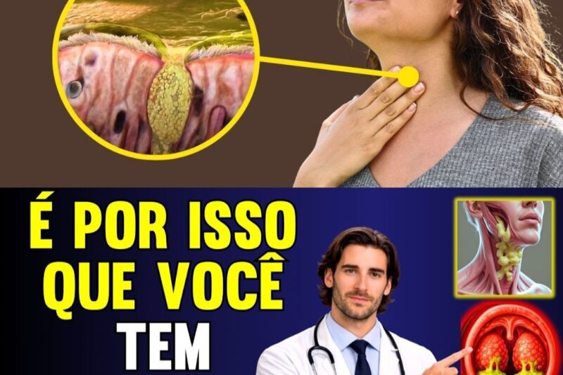 A VERDADEIRA CAUSA DO CATARRO PERSISTENTE: Como Eliminar o Muco na Garganta de Forma Simples e Eficaz