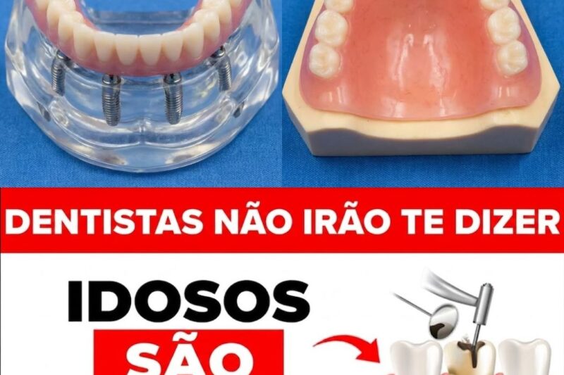 Após os 60 anos, JAMAIS faça esses 3 tratamentos dentários sem uma segunda opinião.