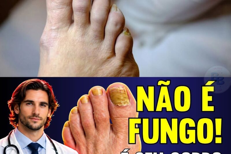 Suas unhas dos pés estão amarelas, grossas ou quebradiças? Atenção, porque isso pode ser muito mais do que apenas um fungo persistente ou um problema estético. O seu corpo está gritando por ajuda e usando os seus pés como o último recurso para enviar um alerta sobre doenças silenciosas como diabetes, má circulação e até deficiências vitamínicas graves. Ignorar esses sinais pode colocar sua saúde em risco. Descubra agora o que cada alteração nas suas unhas revela sobre o seu organismo e como tratar a causa real. Clique no link do primeiro comentário para ler o artigo completo e proteja-se hoje mesmo.