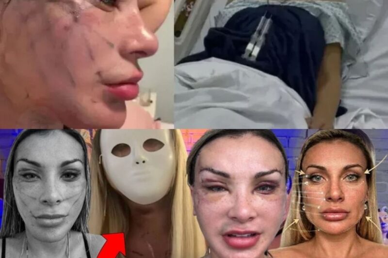 Andressa Urach Surpreende o País Após 40ª Cirurgia e Choca com Reviravolta Espiritual e Estética
