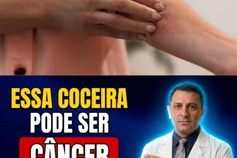 NÃO IGNORE: 5 lugares onde a coceira persistente pode ser um SINAL SILENCIOSO de câncer! Muita gente confunde com alergia simples ou pele seca, mas o corpo pode estar enviando um pedido de socorro desesperado. Identificar esse sintoma precocemente pode ser a diferença entre a cura e uma batalha difícil. Você sabe onde coça e o que isso realmente significa? Descubra agora quais são as áreas de risco e o que fazer imediatamente no primeiro comentário abaixo!
