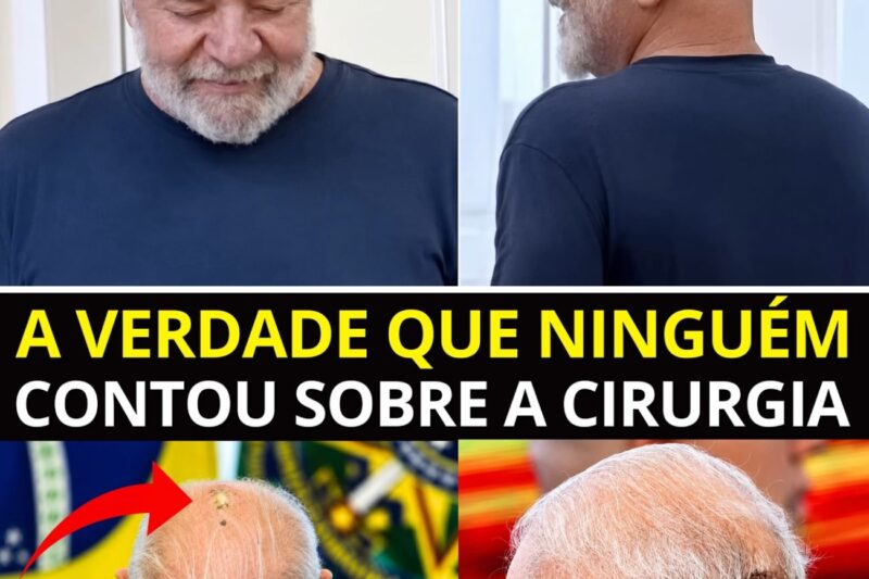 “ELES ESTÃO ESCONDENDO O CANCRO NA CABEÇA DELE PORQUE O PLANO É COLOCAR O HADAD NA VICE E ASSUMIR O PODER EM UM ANO!”: A Verdade Ocultada Sobre A Cirurgia De Lula No Sírio-Libanês, O Tratamento Secreto De Radioterapia E A Manobra De Bastidores Para Substituir Alckmin Na Próxima Eleição